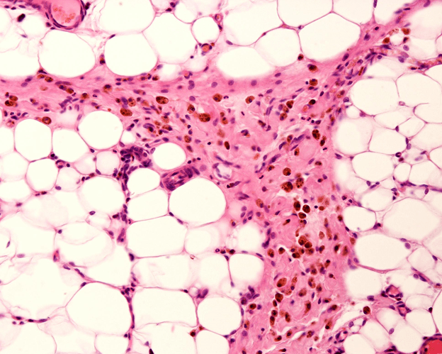 Mechanisms Behind Peptide Driven Lipolysis in Experimental Settings